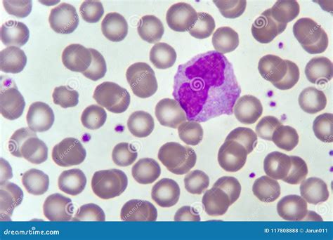 Monocyte Cell In Blood Smear Stock Photo Image Of Anemia Hematology