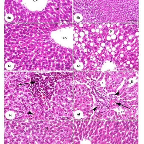 Photomicrographs Of Liver Sections A Control Group Showing Central Download Scientific