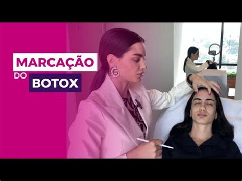 Marca O De Botox E Os M Sculos Da Face Youtube