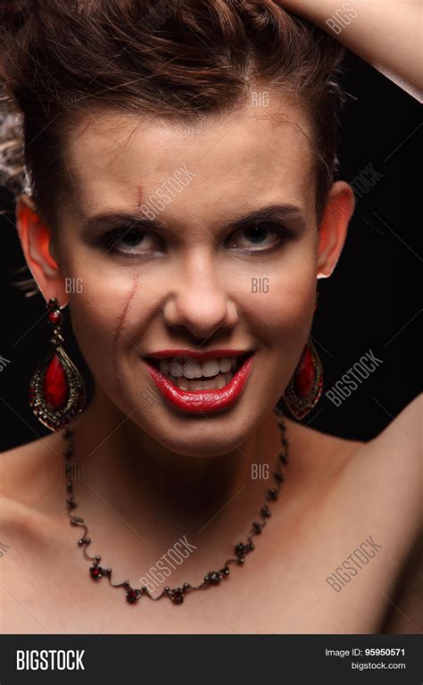 Beautiful Girl Scar On Image And Photo Free Trial Bigstock