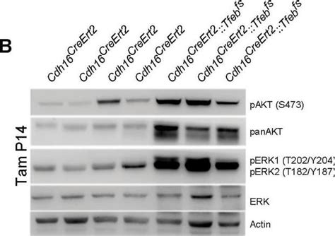 Human Mouse Rat Phospho ERK1 T202 Y204 ERK2 T185 Y187 Antibody