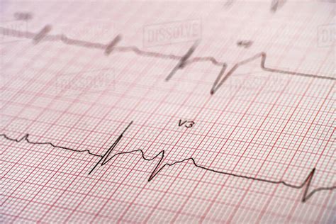 Electrocardiogram On Red Graph Paper Stock Photo Dissolve