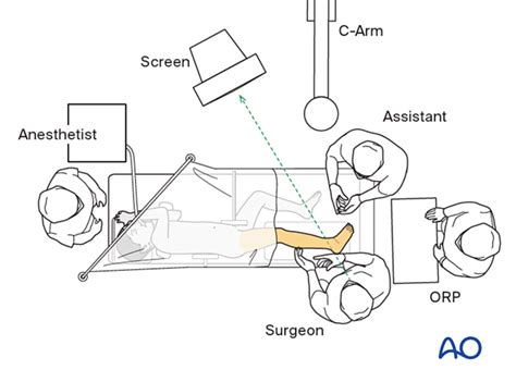 patient preparation  lateral decubitus position