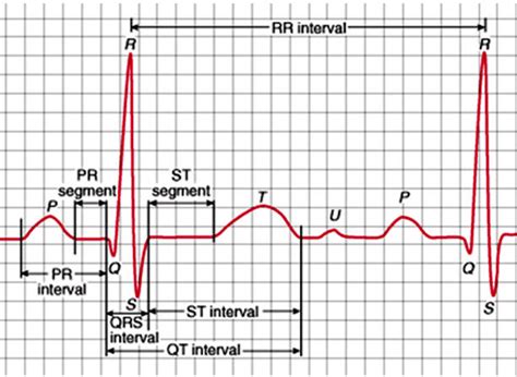 Ekg Leads Stock Photos Pictures And Royalty Free Images Istock