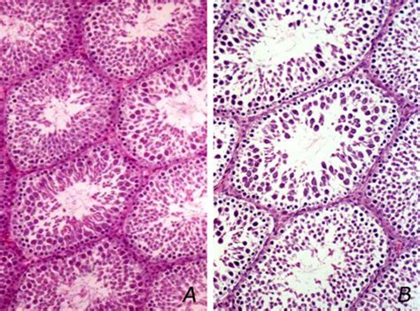 Photomicrograph Of The Seminiferous Tubules Of Control Group A