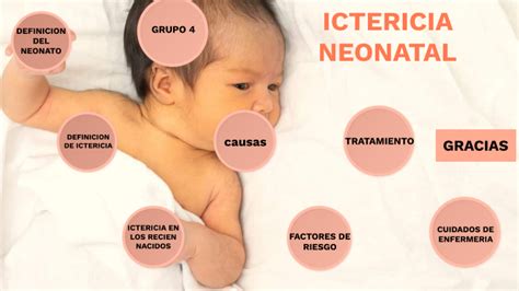 Ictericia Neonatal By Ruth Telada On Prezi