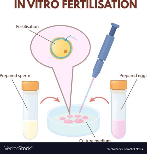 In vitro fertilization Royalty Free Vector Image