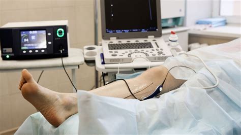 Laser Varicose Vein Surgery Duration Cost And Step By Step