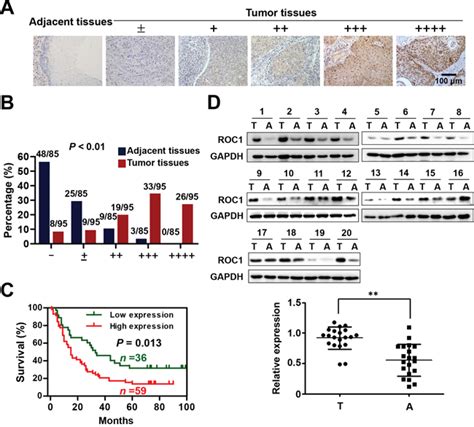 Targeting The Overexpressed Roc1 Induces G2 Cell Cycle Arrest And