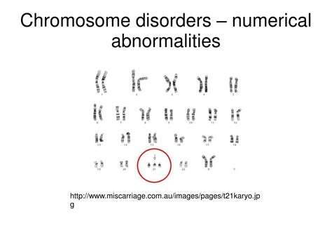 Ppt Chromosome Disorders Numerical Abnormalities Powerpoint Presentation Id9104114