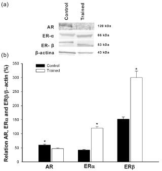 Representative Western Blot A And Semi Quantitative Determination B