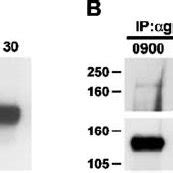 Western Blotting And Co Immunoprecipitation Of LIFR And Gp130 In The