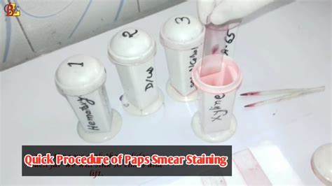 Quick Procedure Of Paps Smear Staining Youtube