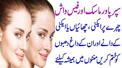 How To Get Rid Of Acne Problem At Home Natural Pimples Dane Khatam