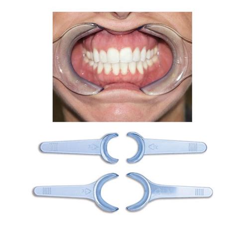 Photo Cheek Retractor - Ortho Technology