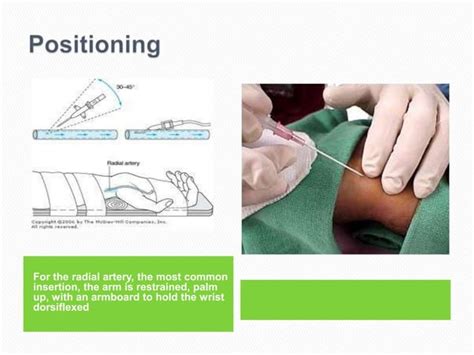 Arterial line insertion | PPT