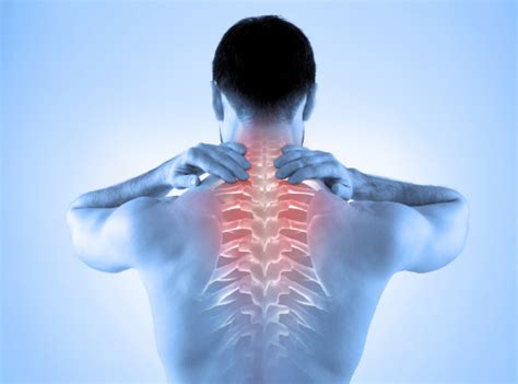 What Chiropractic Patients Want to Know About Cervical Facet Joint Pain ...