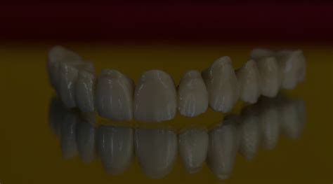 Zirconia Dental Bridges What Are They And When Are They Indicated