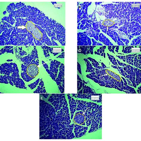 Histopathological Slides Of Rat Pancreas Cells After 7 Days Of Download Scientific Diagram