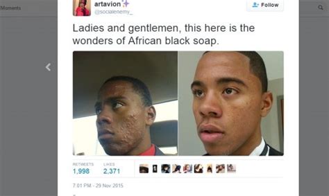 african black soap acne before & after | African black soap acne ...