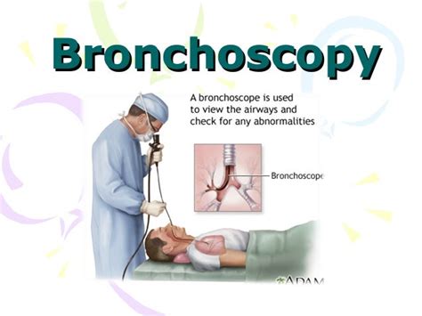 Bronchoscopy Diagnostic Technique