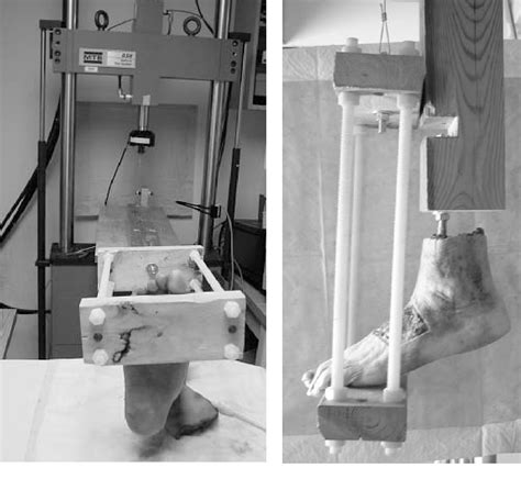 Figure From Ligamentous Lisfranc Joint Injuries A Biomechanical