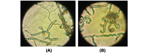 Spore Morphology Of The Active Isolates A Spores Chainsc 26 And