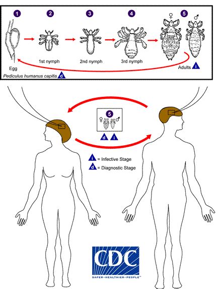 Cdc Dpdx Pediculosis