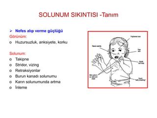 Solunum S K Nt S Olan Ocuk Hastaya Yakla M Ppt