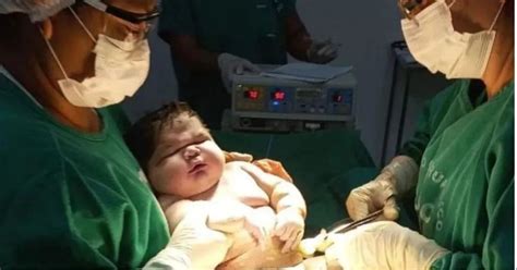 7 3 kilos et 60 cm elle accouche d un des plus gros bébés du monde