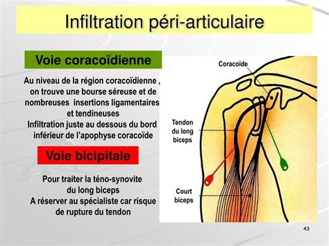 PPT PATHOLOGIE PERI ARTICULAIRE PowerPoint Presentation Free