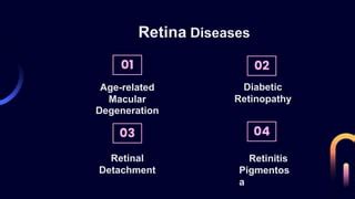 Understanding Retina Diseases | PPT