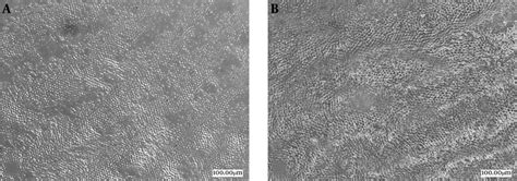 Digital microscopy of human enamel surfaces. A, control sample, B ...