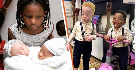 Black Couple Gives Birth To Identical Set Of Twins With Variations In