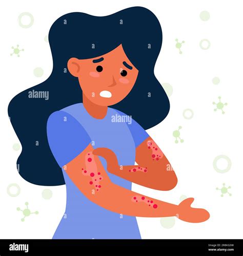 Woman With Strong Allergy Symptoms Flat Vector Illustration Stock