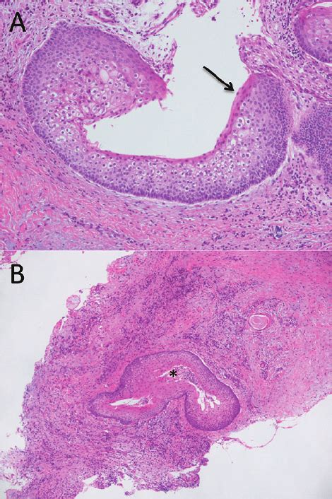 Histopathological Findings Of The Tumor Hematoxylin And Eosin