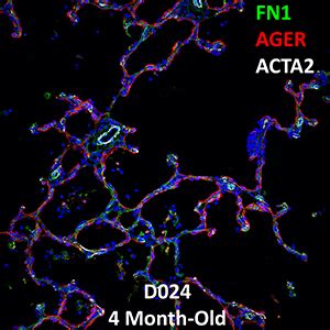 Month Old Human Lung Confocal Imaging Donor D Fn Ager And Acta