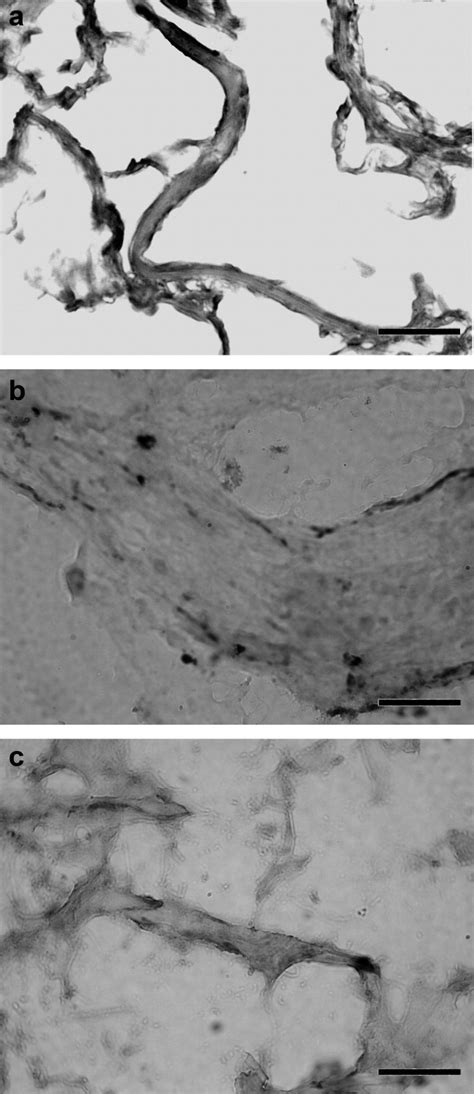 Morphology and Innervation of the Human Cremaster Muscle in Relation to ...