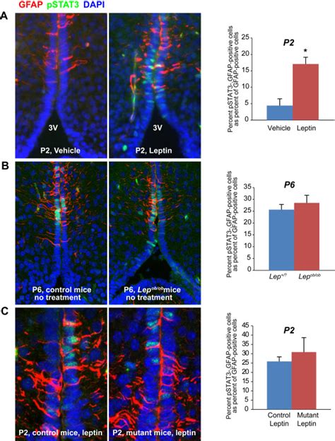 GFAP Expressing Cells In The Periventricular Zone Of The 3rd Ventricle