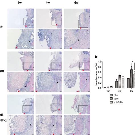 Histological Analysis Of Bone Defects At 1 4 And 6 Weeks A He Download Scientific Diagram