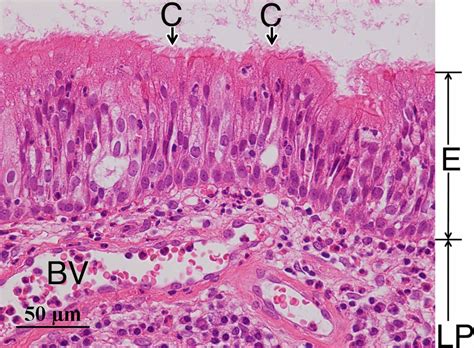 Histopathology Of Maxillary Sinus Mucosa With Odontogenic Maxillary