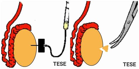 Top 10 Male Fertility Glossaries You Need To Know Ziva Fertility