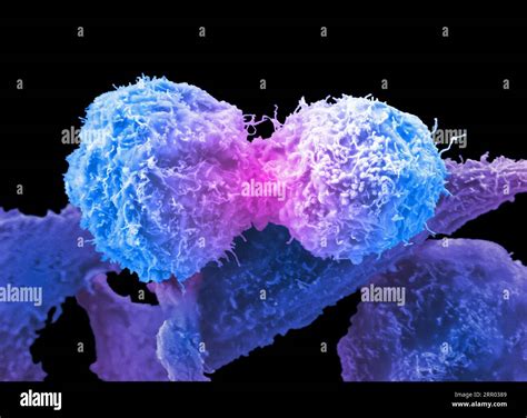 Prostate Cancer Cells Dividing Sem Stock Photo Alamy