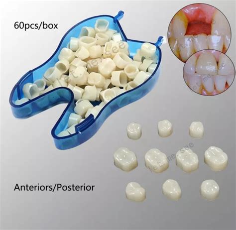 Dental Resin Realistic Porcelain Temporary Tooth Crown Anterior