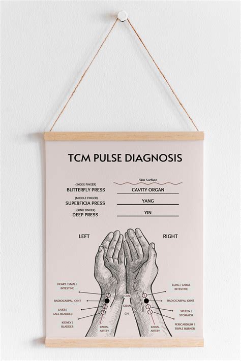 Tcm Pulse Chart Poster Traditional Chinese Medicine Pulse Reading Art