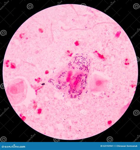 Bacillus Gram Positive Stain Under Microscope View Bacillus Is Rod