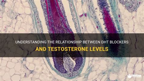 Understanding The Relationship Between Dht Blockers And Testosterone Levels Medshun