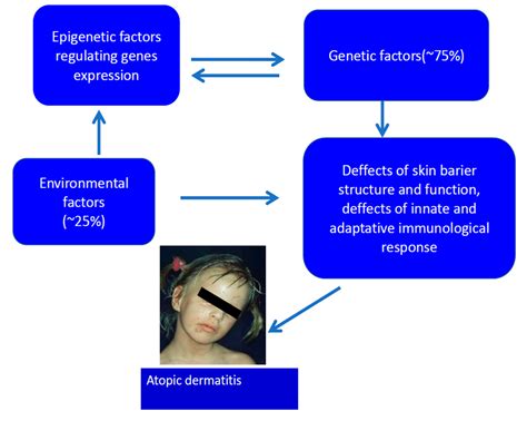 Ijms Free Full Text Genetic And Epigenetic Aspects Of Atopic Dermatitis