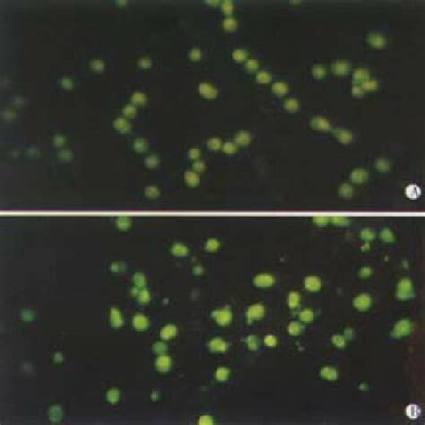 VES Induced Apoptosis In SGC 7901 Cells With Transmission Electron