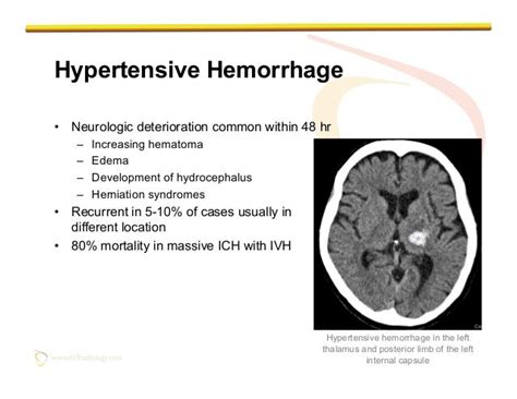 Imaging Of Non Traumatic Intracranial Hemorrhage